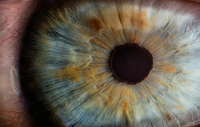 Close-up of a human eye