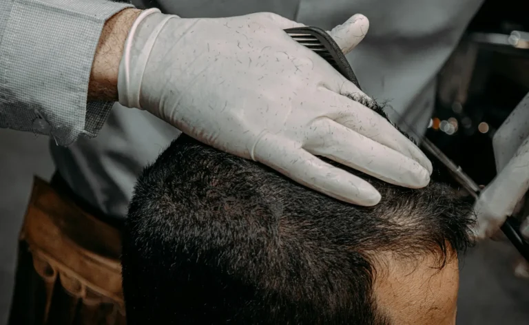 Gloved hands checking a man’s hair and hairline